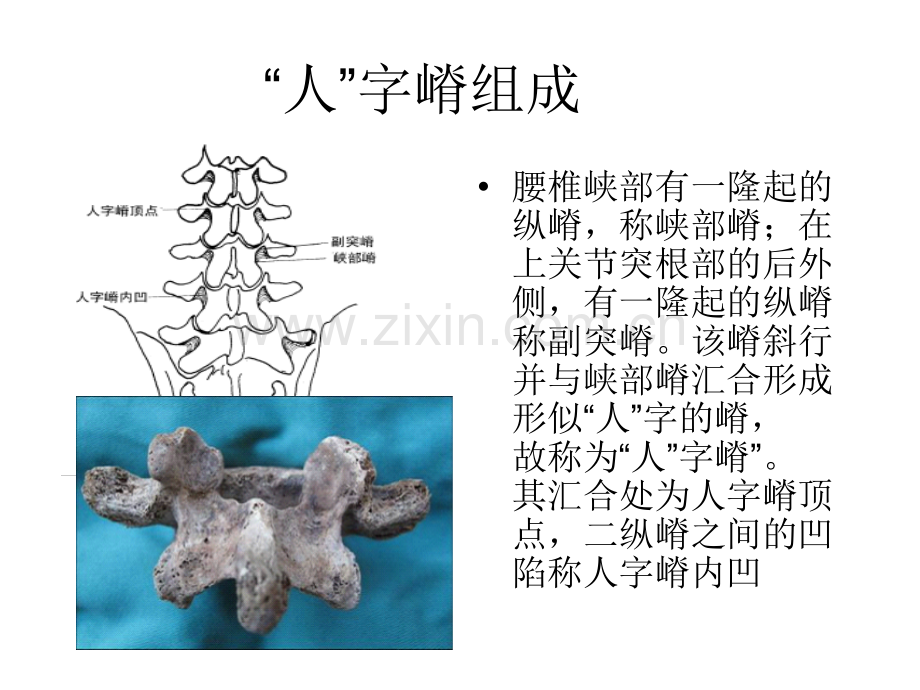人子脊解剖.ppt_第2页