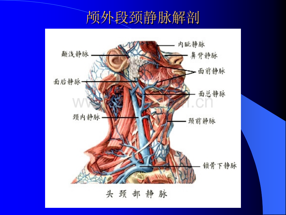 颈静脉球瘤.ppt_第2页