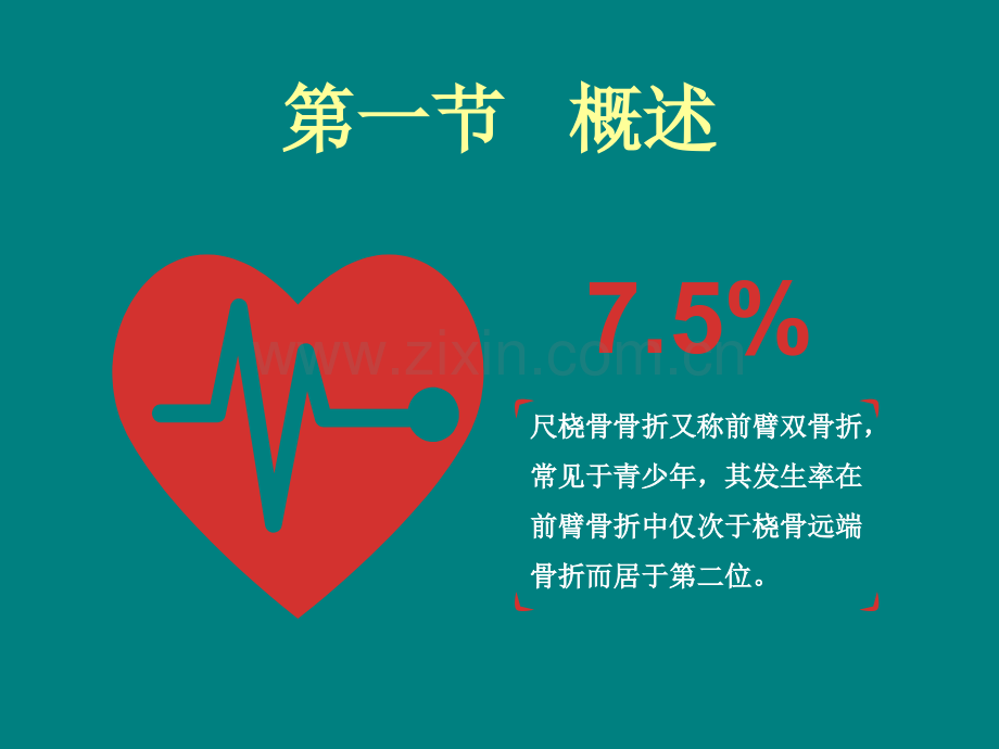 尺桡骨骨折PPT.ppt_第2页