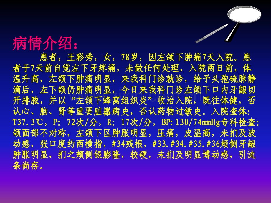 颌下蜂窝组织炎.ppt_第2页