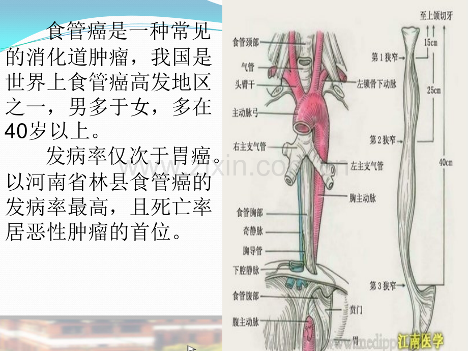 食-管-癌.ppt_第2页