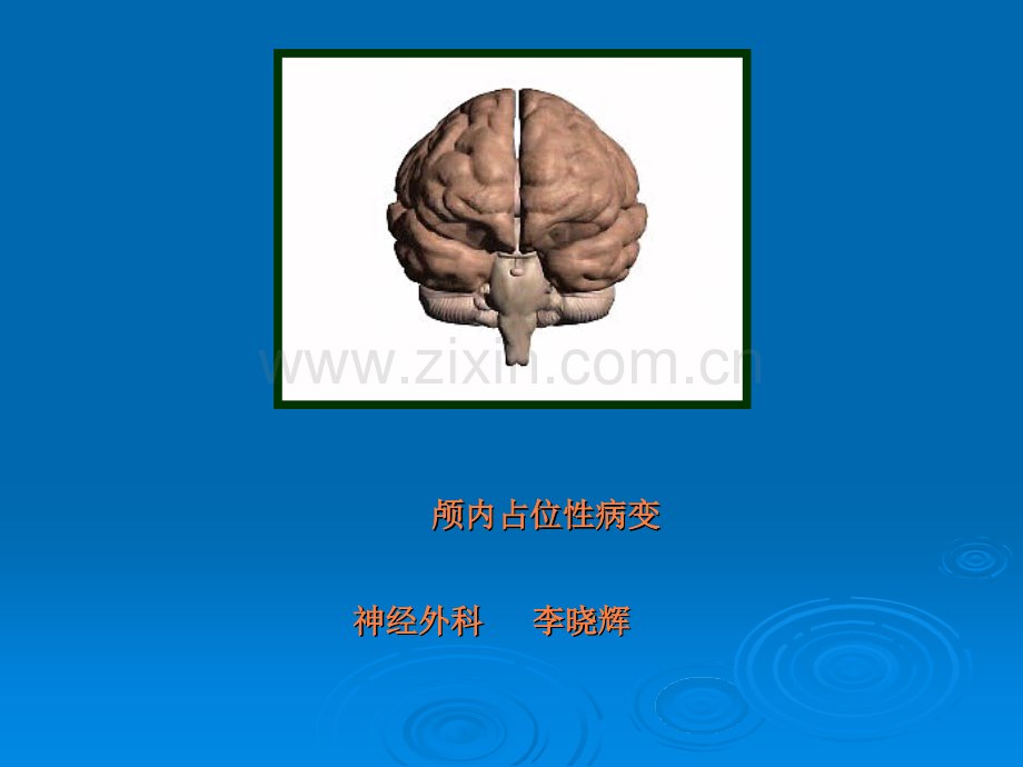 颅内占位.ppt_第1页
