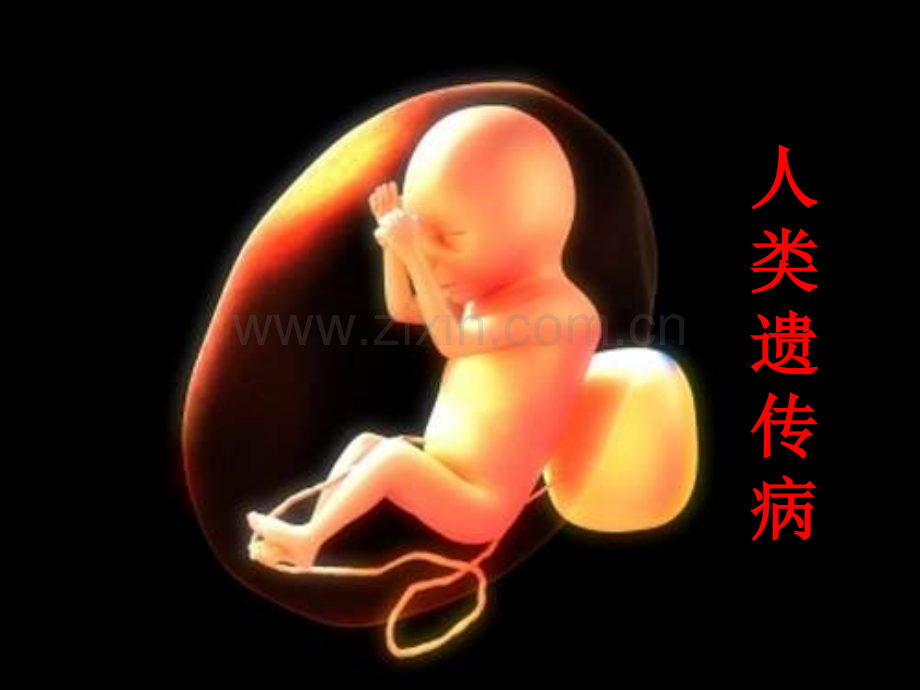人类遗传病专题复习.ppt_第1页