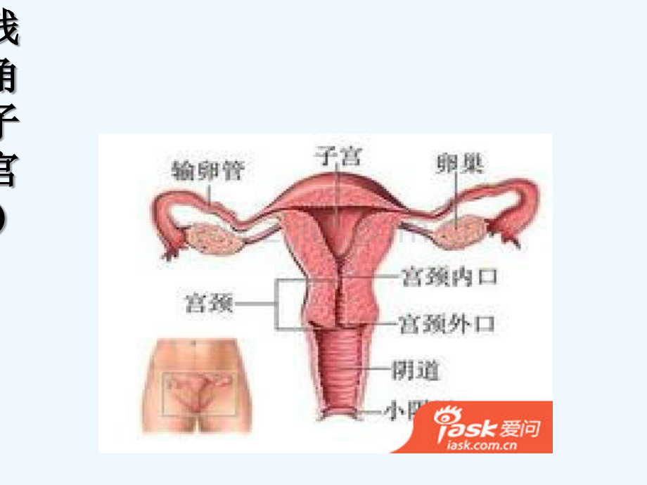 残角子宫.ppt_第2页