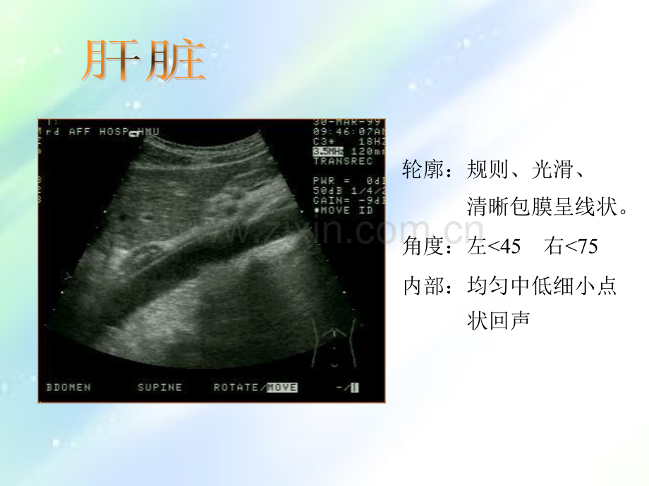 常见病B超图谱.ppt_第1页