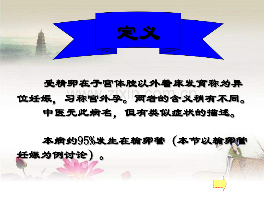 中医妇科异位妊娠.ppt_第2页