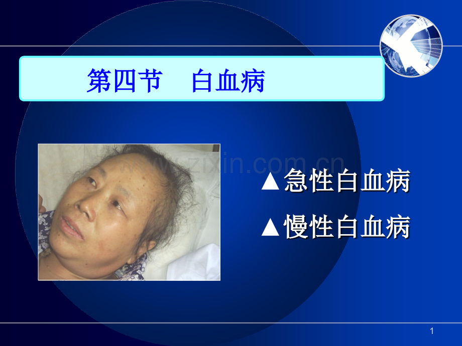慢性淋巴细胞白血病1.pptx_第1页
