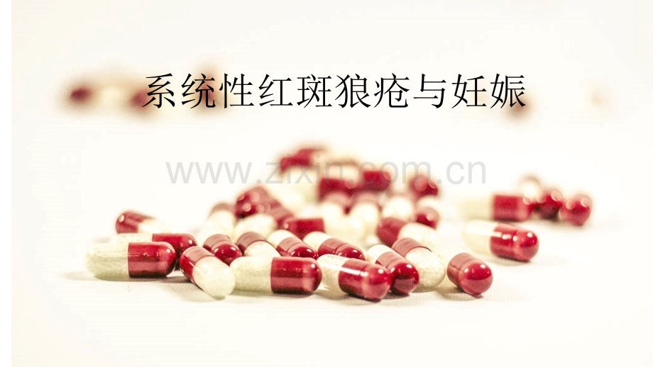 SLE与麻醉-PPT.ppt_第1页