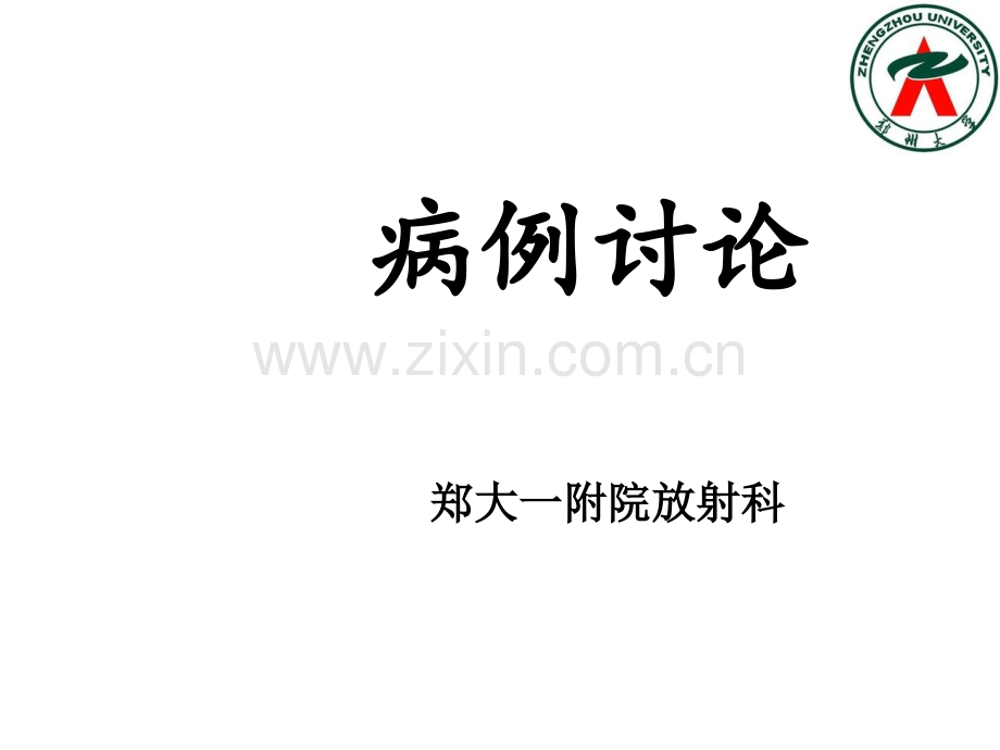 神经鞘瘤.ppt_第1页