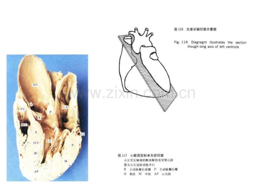 心脏超声科室讲座.pptx_第2页