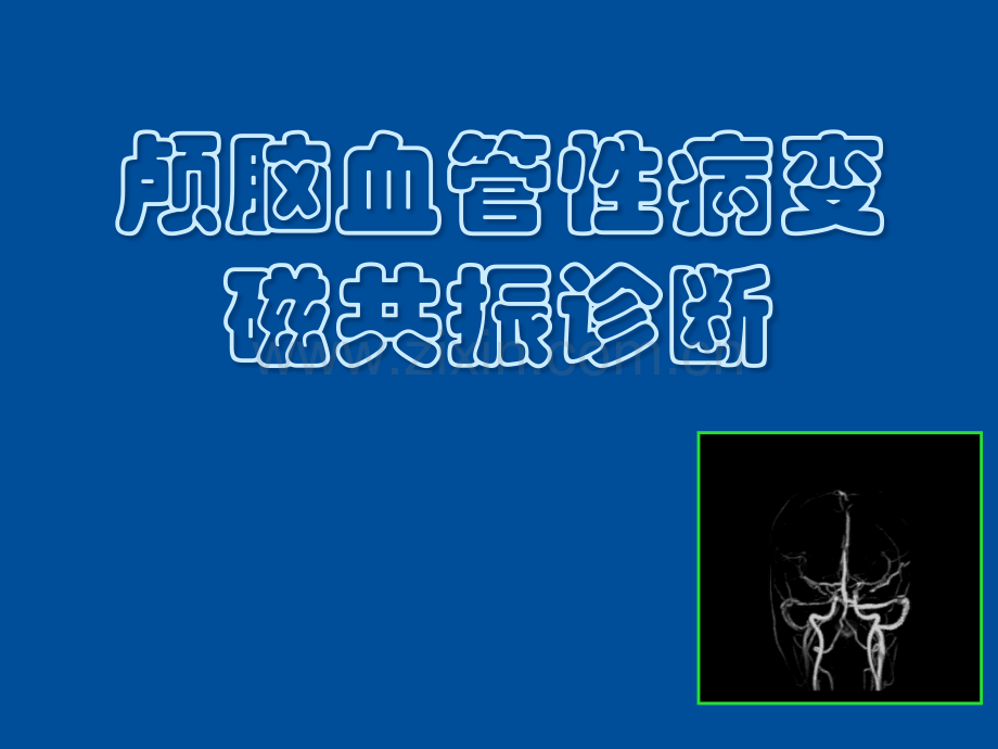颅脑疾病的核磁共振诊断价值MRI-(2).ppt_第1页