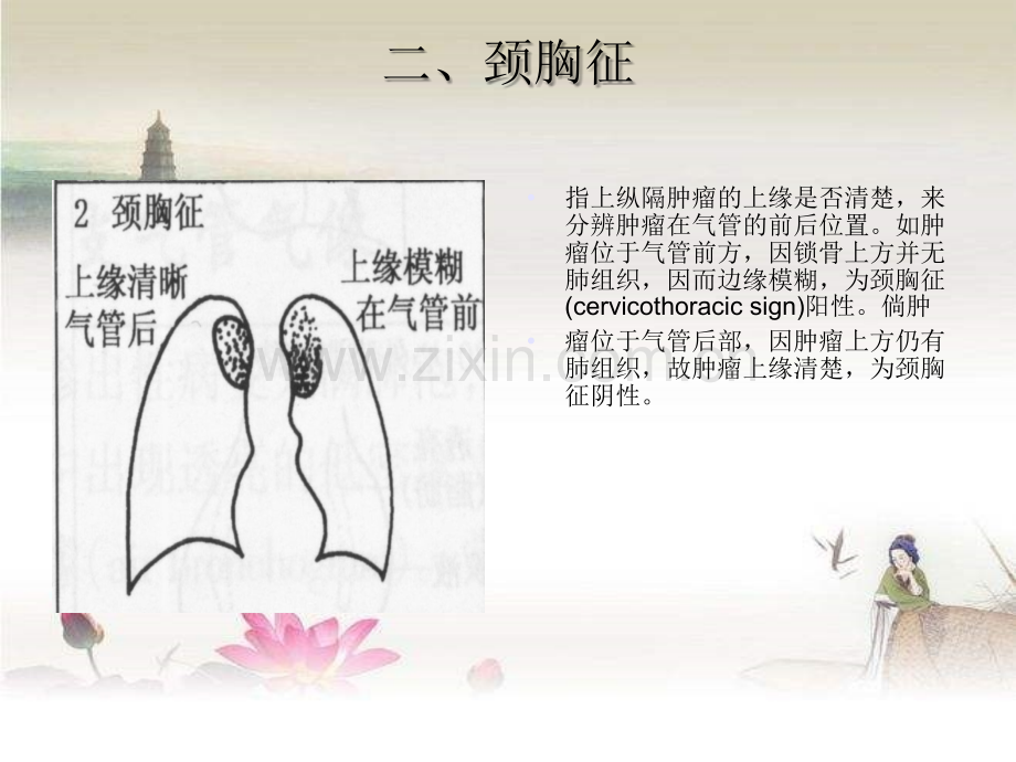 胸部X线征象.ppt_第2页