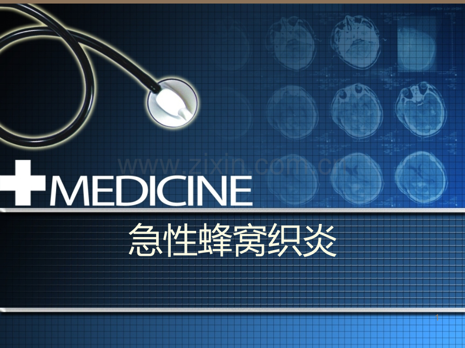 急性蜂窝织炎.ppt_第1页