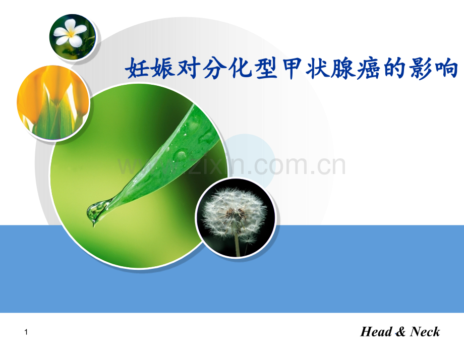 妊娠对分化型甲状腺癌的影响(1).ppt_第1页