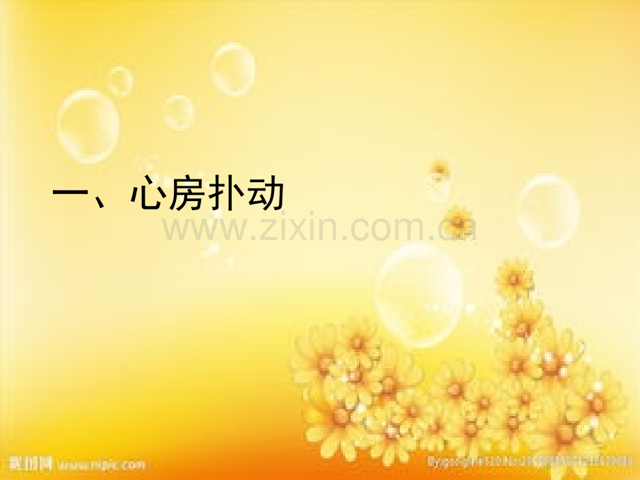 扑动与颤动心电图表现.ppt_第2页