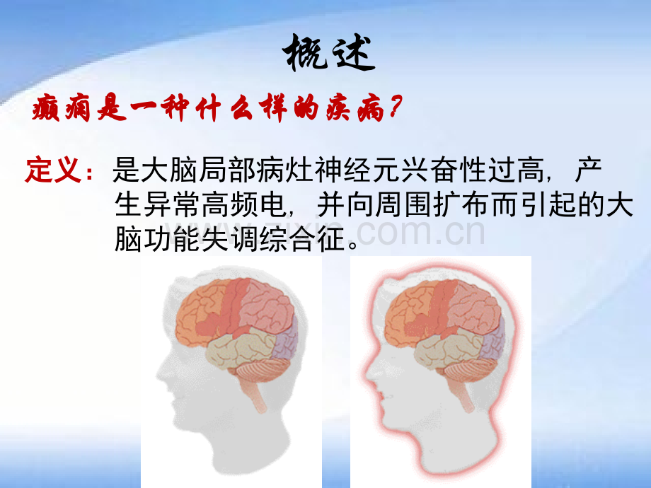 抗癫痫与惊厥药.ppt_第2页