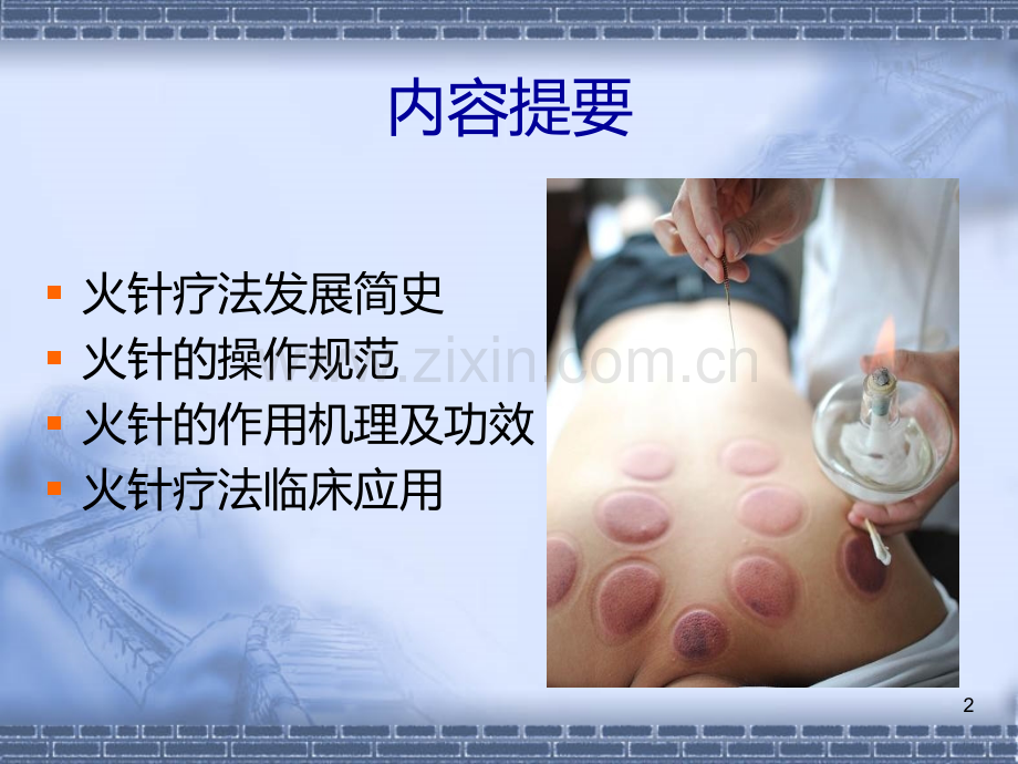 火针疗法研究进展及临床实践.ppt_第2页