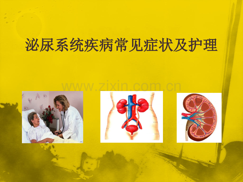 泌尿系统疾病常见症状体征的护理.ppt_第1页