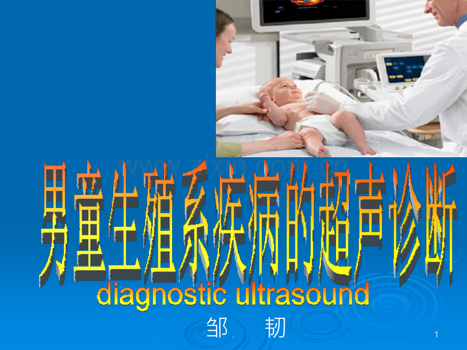 男童生殖系疾病超声诊断.ppt_第1页