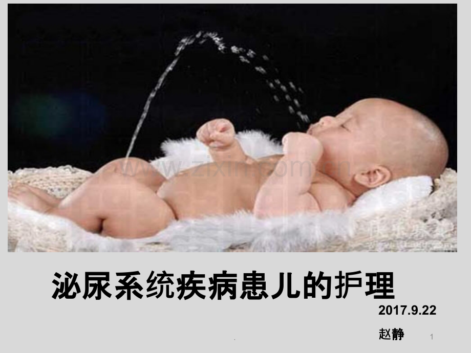 泌尿系统疾病患儿的护理.ppt_第1页