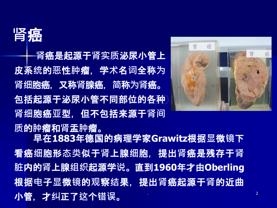 肾癌护理.ppt_第2页