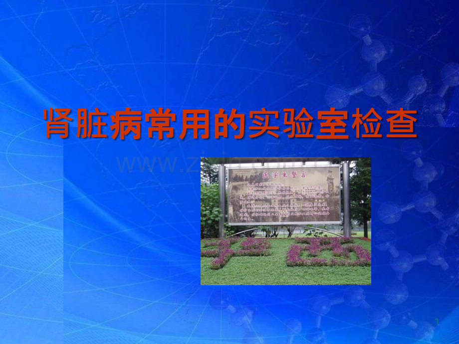 肾脏病常用实验室检查.ppt_第1页