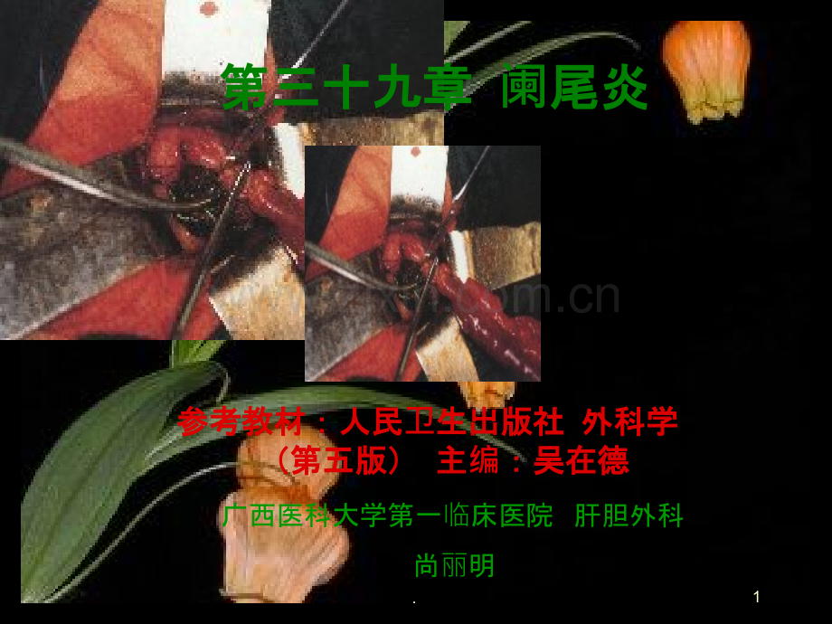 教学阑尾炎.ppt_第1页