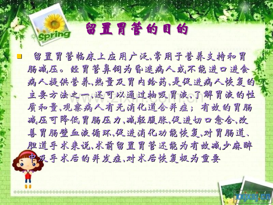 留置胃管.ppt_第2页
