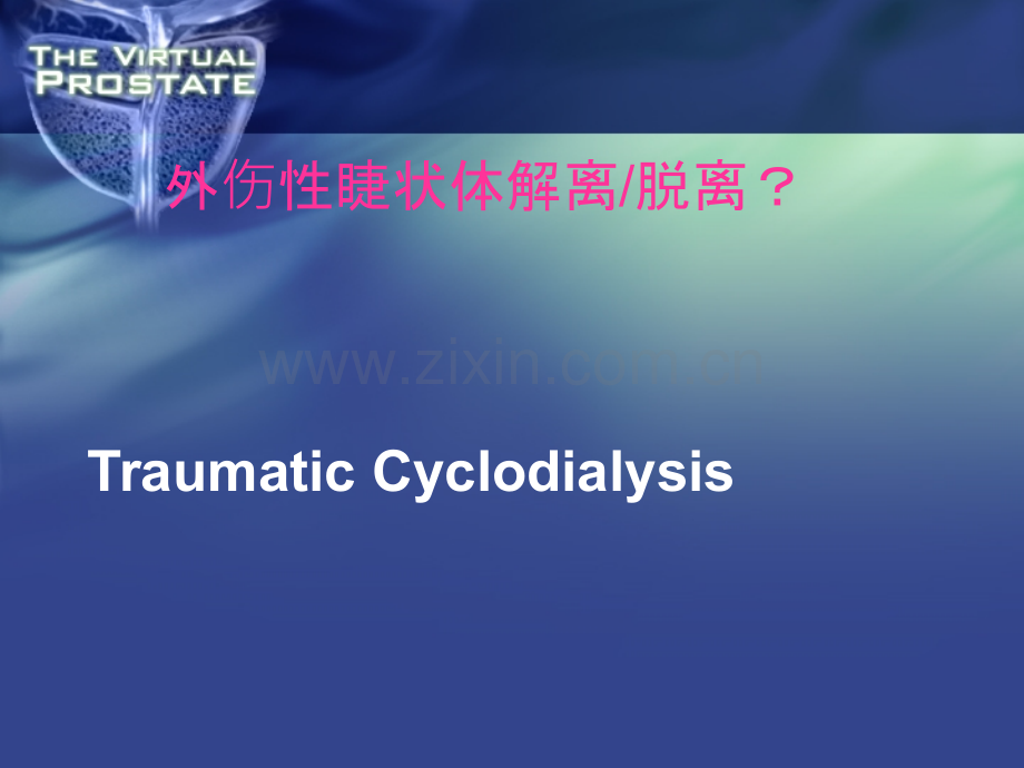 睫状体分离.ppt_第1页