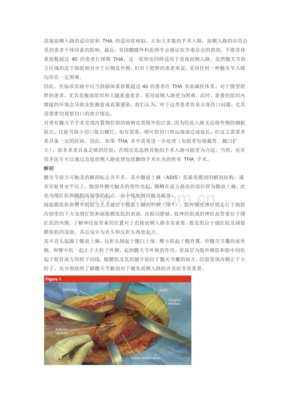 全髋关节置换术前侧入路的手术技巧资料.doc_第2页