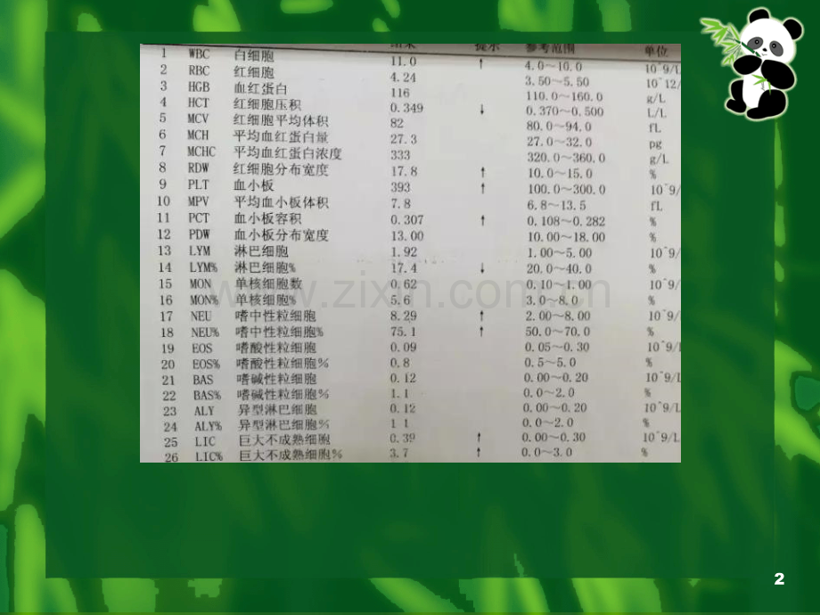 儿童胃炎gastritisinchildren英文.pptx_第2页