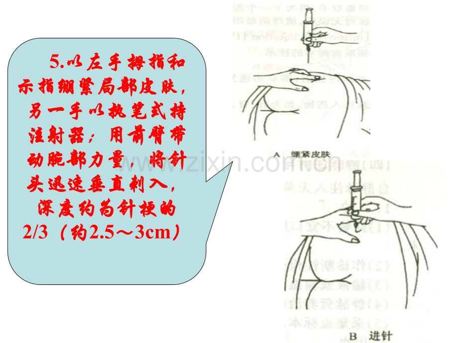 用前臂带动腕部力量将针头迅速垂直刺入深约为针梗.pptx_第1页