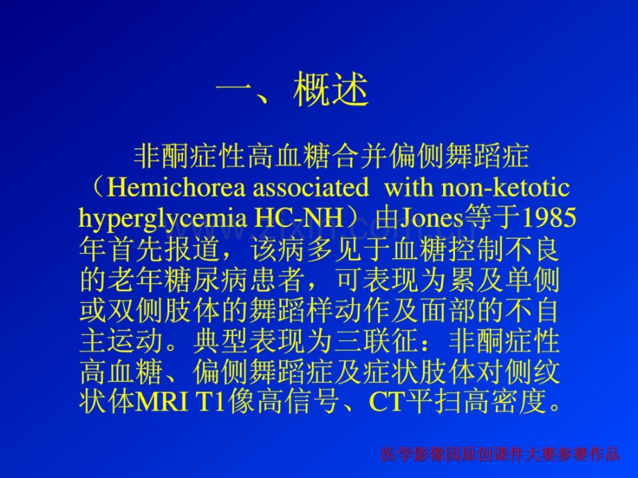 非酮症性高血糖回并偏侧跳舞症.pptx_第2页