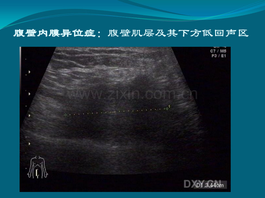 超声笔记.pptx_第2页