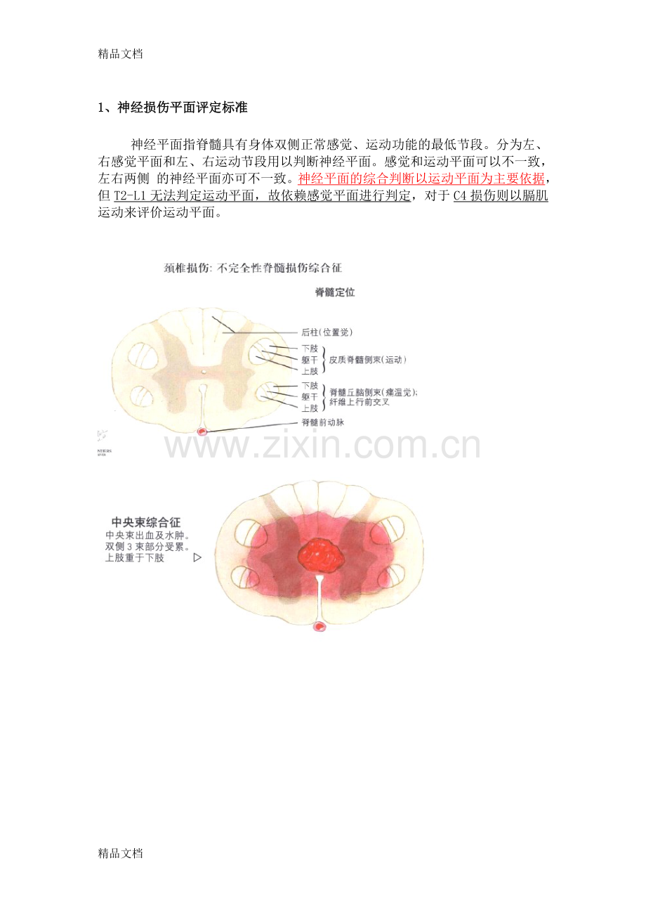 脊髓损伤-读书笔记教学文稿.doc_第1页