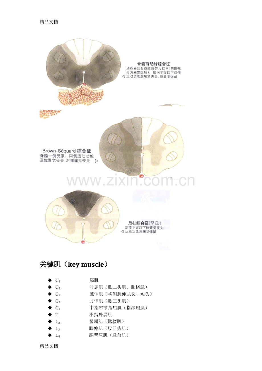 脊髓损伤-读书笔记教学文稿.doc_第2页