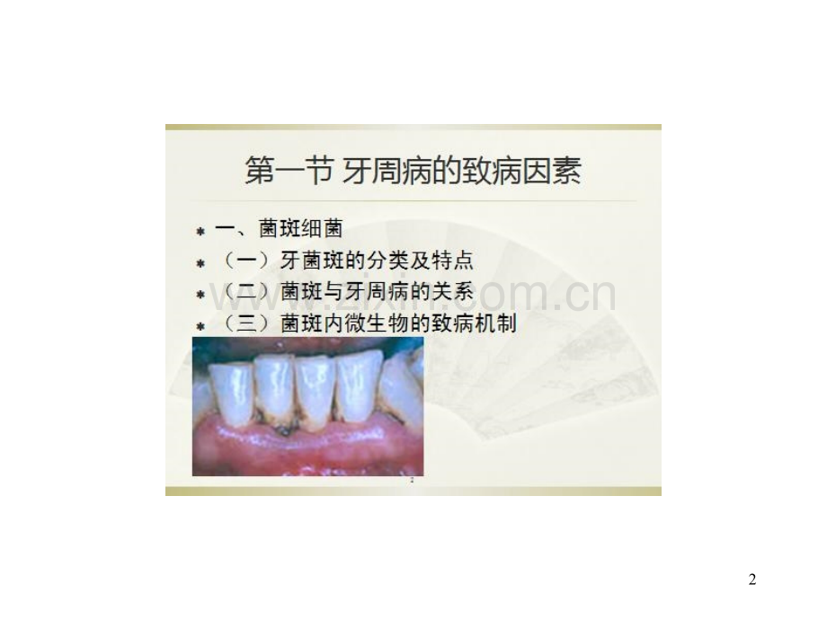 口腔预防医学牙周病的预防.pptx_第2页