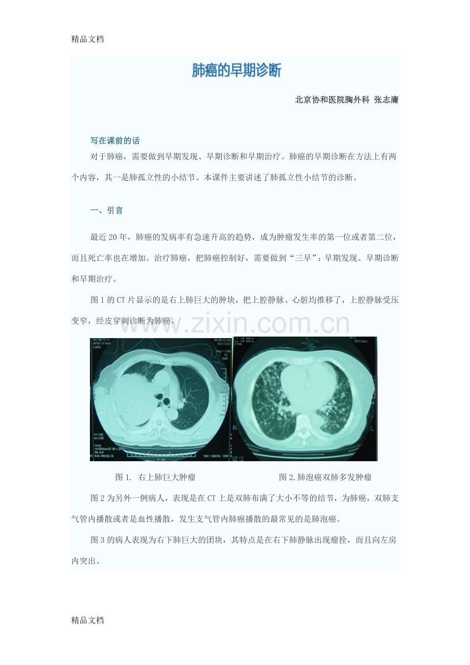 肺内结节鉴别资料.doc_第1页