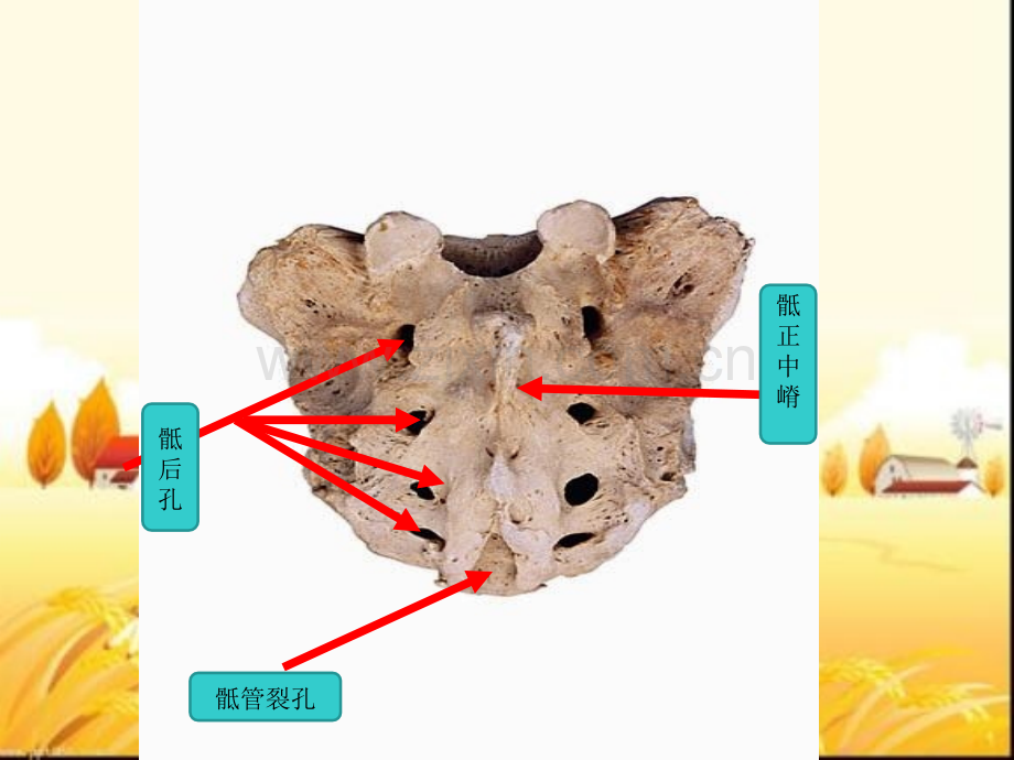 临床本科系统解剖学标本考试.pptx_第2页
