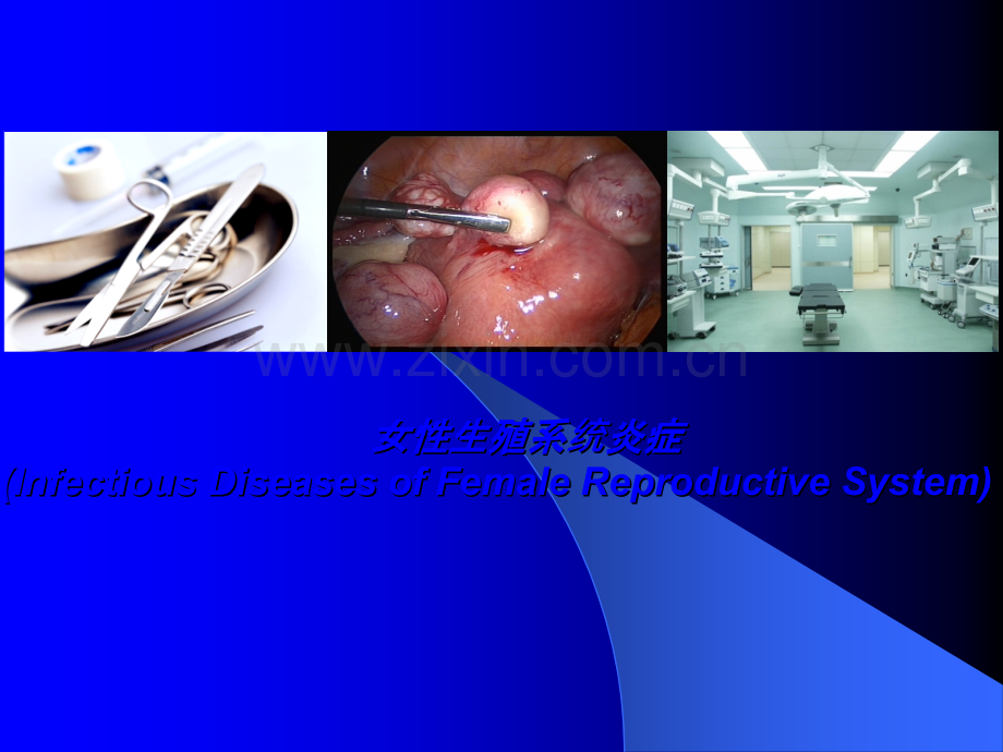 各种阴道炎ppt课件.ppt_第1页