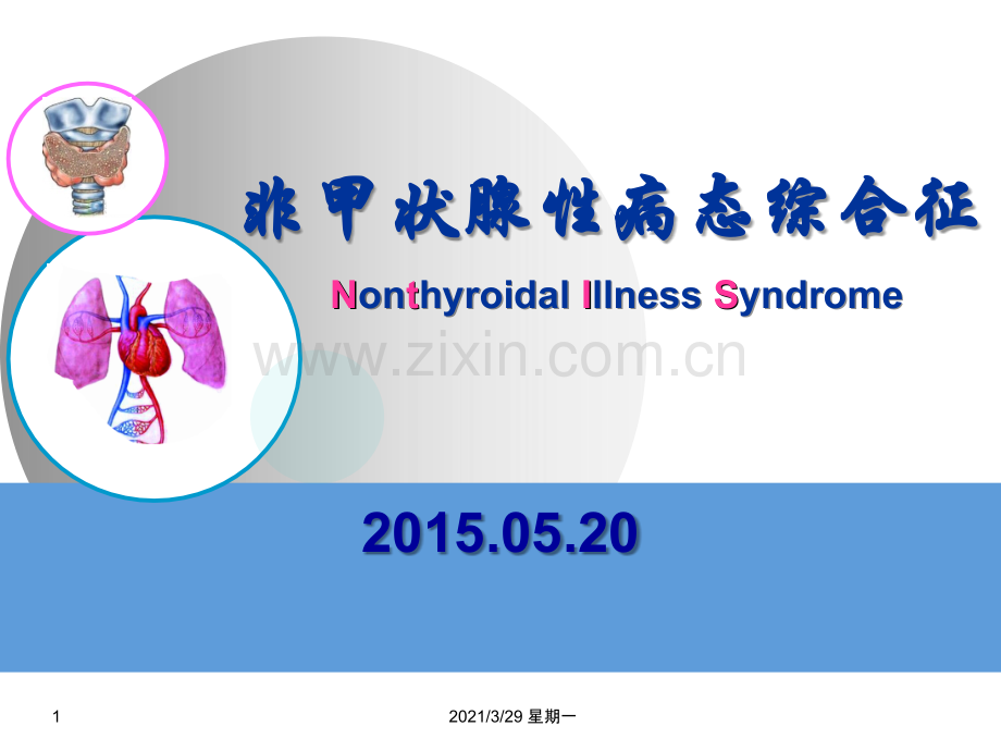 NTIS-甲状腺功能正常病态综合征.ppt_第1页