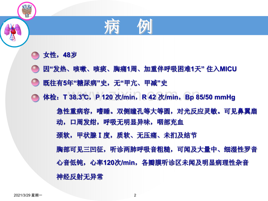 NTIS-甲状腺功能正常病态综合征.ppt_第2页