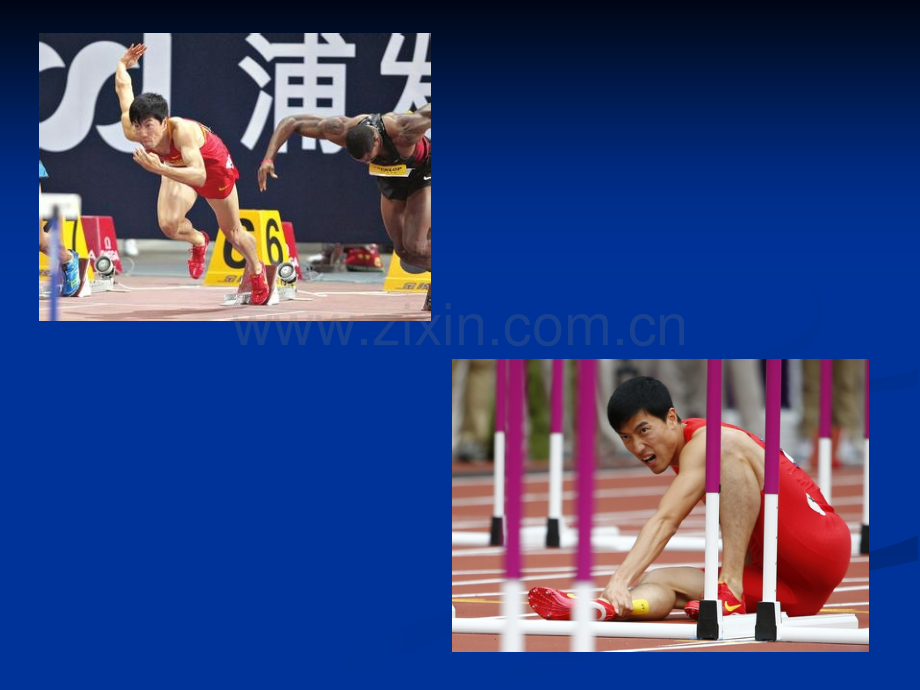 跟腱断裂-.ppt_第1页
