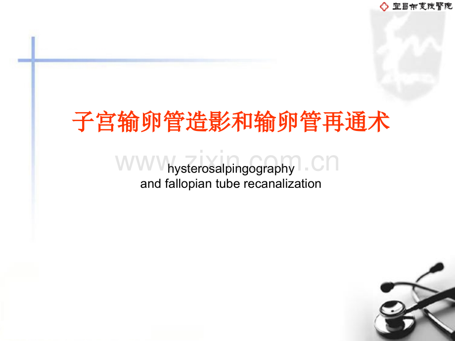 选择性输卵管造影和再通术.ppt_第1页