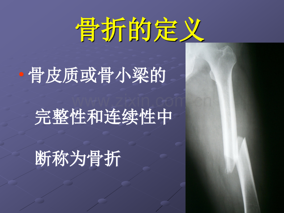 《上二医骨科3》.ppt_第1页