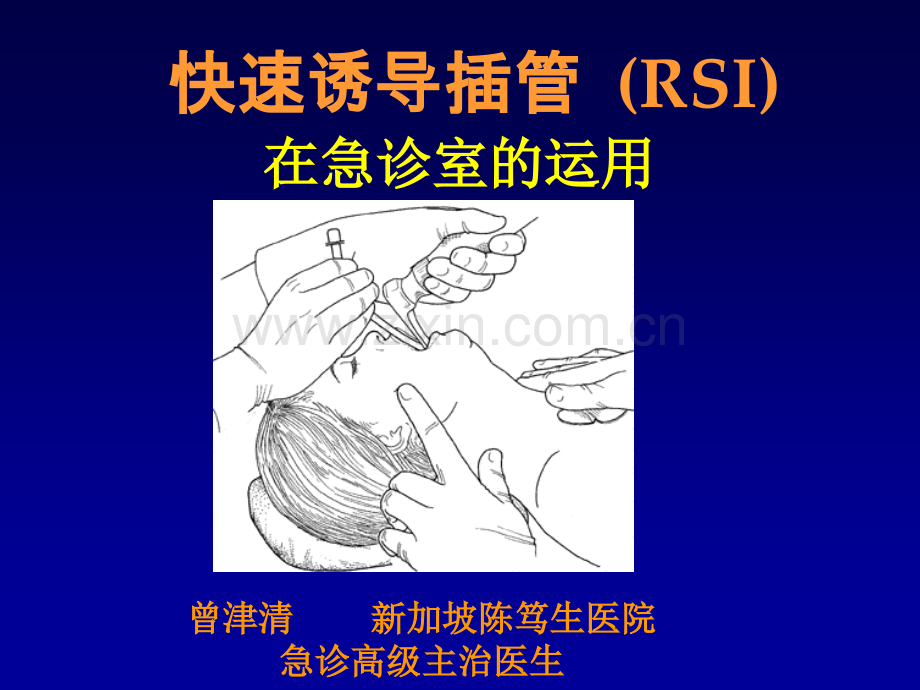快速诱导插管(RSI)在急诊室的运用.ppt_第1页