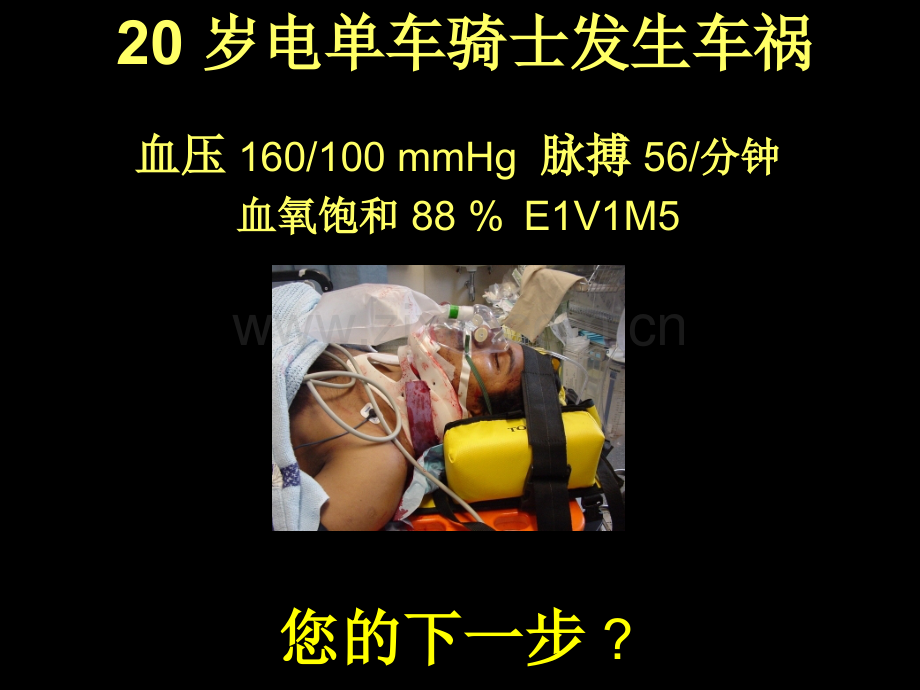 快速诱导插管(RSI)在急诊室的运用.ppt_第2页