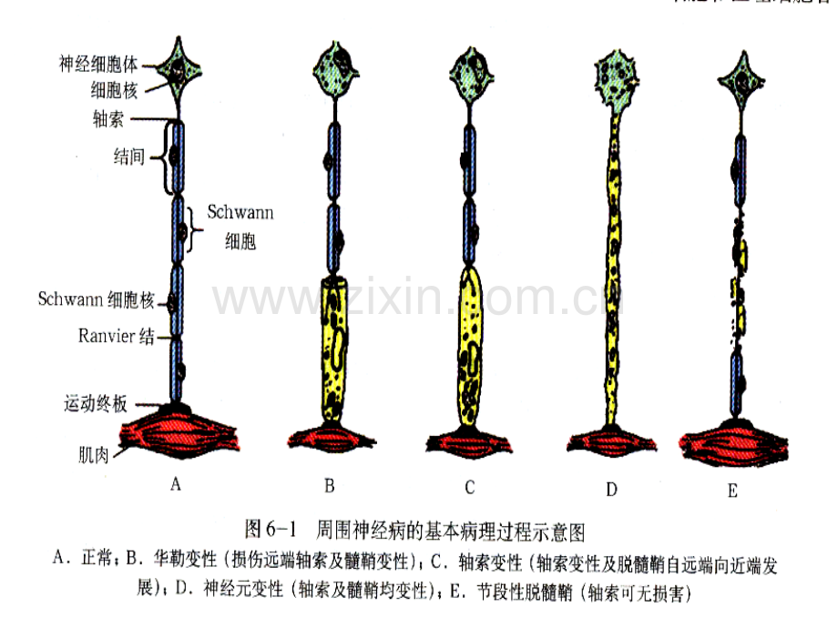 教学课件周围神经病.pptx_第2页