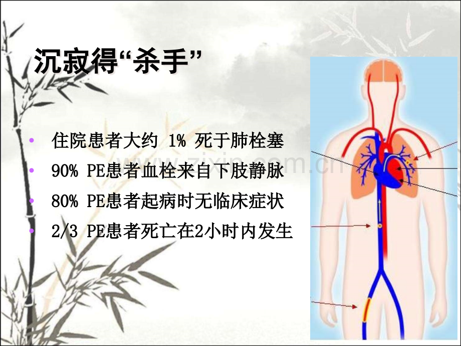 神经内科长期卧床患者下肢深静脉血栓的早期干预.pptx_第2页