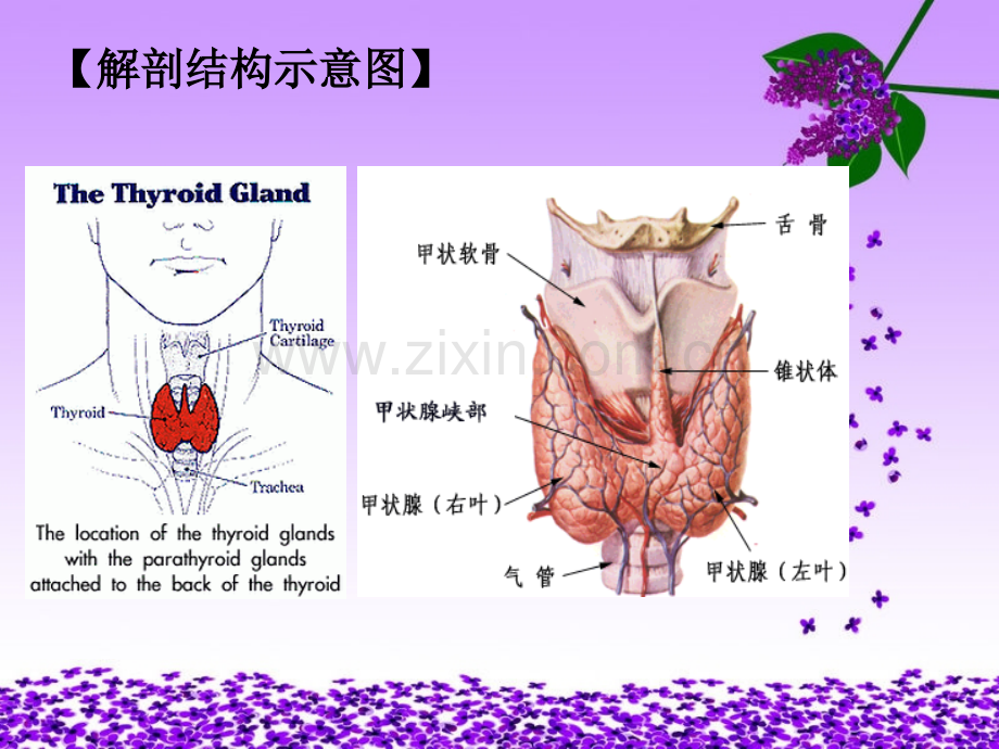 甲状腺危象病人的护理.ppt_第2页